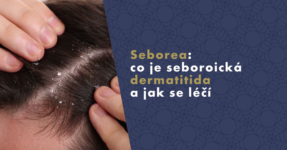 seborea-seboroicka-dermatitida (1)